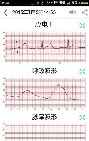 乔松健康管家